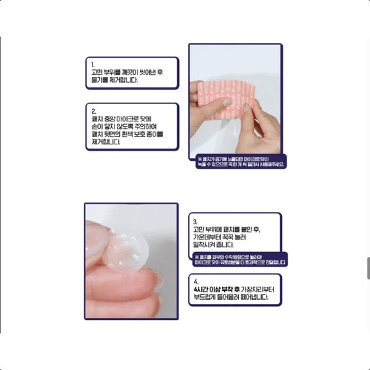 Olive Young CarePlus Zinc Salicylic Acid Trouble Patch 12+12