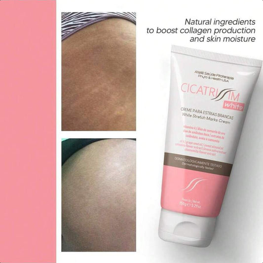 CICATRI White Stretch Mark Fade And Removal Cream 150g/5.29 Oz - Innovative Formula With Pure
