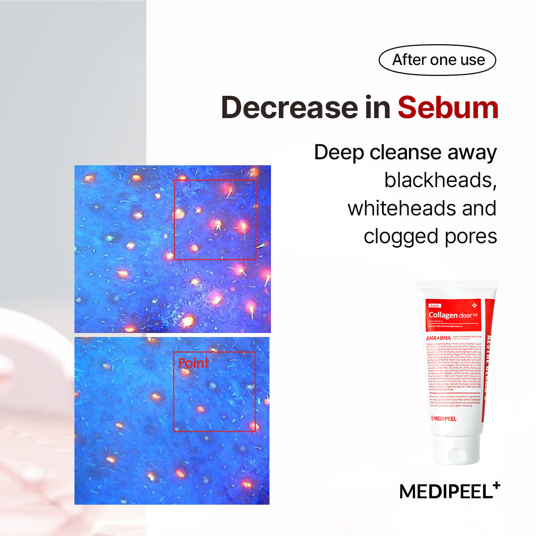 MEDIPEEL Red Lacto Collagen Clear 2.0 Bouncy Skin Cleansing Foam (UPGRADED) 120ml/300ml (Cleanser, Facial, Probiotics, Collagen, Skincare, Korea, Pore Shrinking)