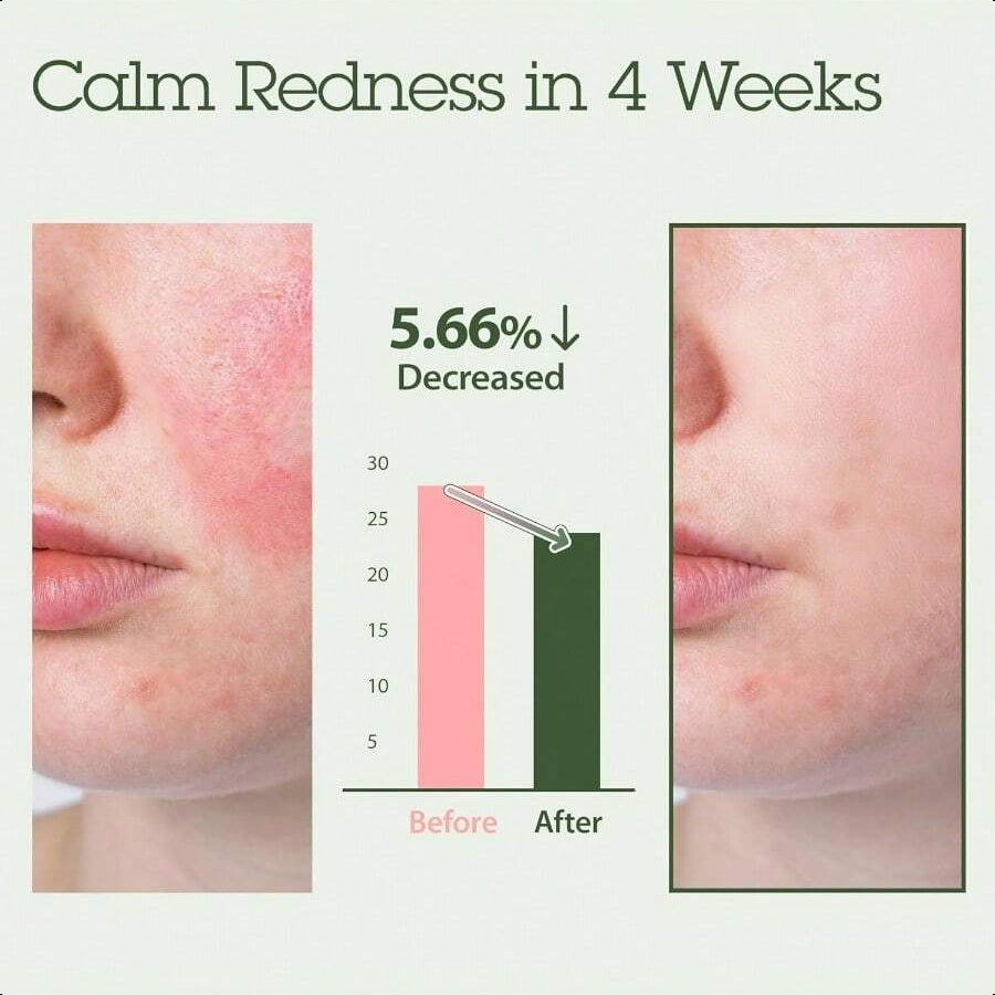 Blithe Korean Skin Care Products 6 Leaves Clear Essence For Rosacea & Redness Relief