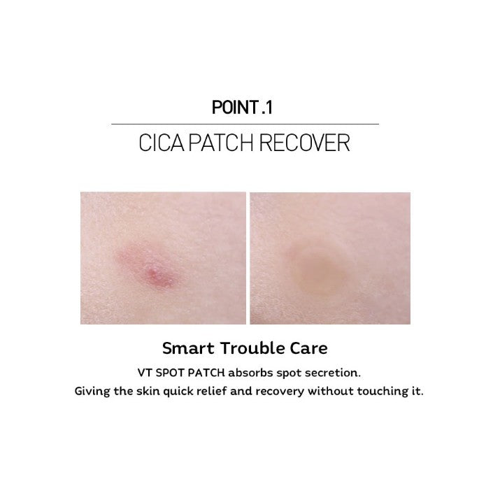 [VT COSMETICS] VT Spot Patch 48 Patches / Pimple Patch / Acne Patch