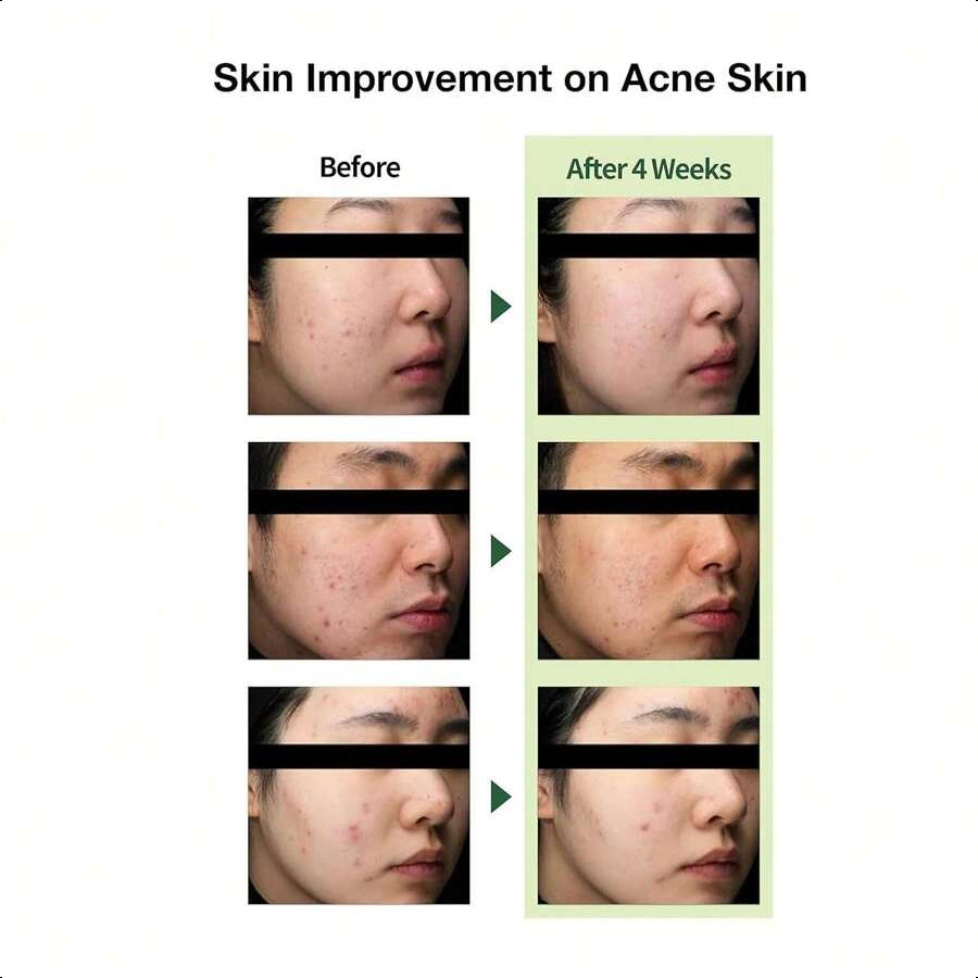 THE LAB by blanc doux Lightweight Trouble Care Daily Moisturizer 50ml/1.69 Oz