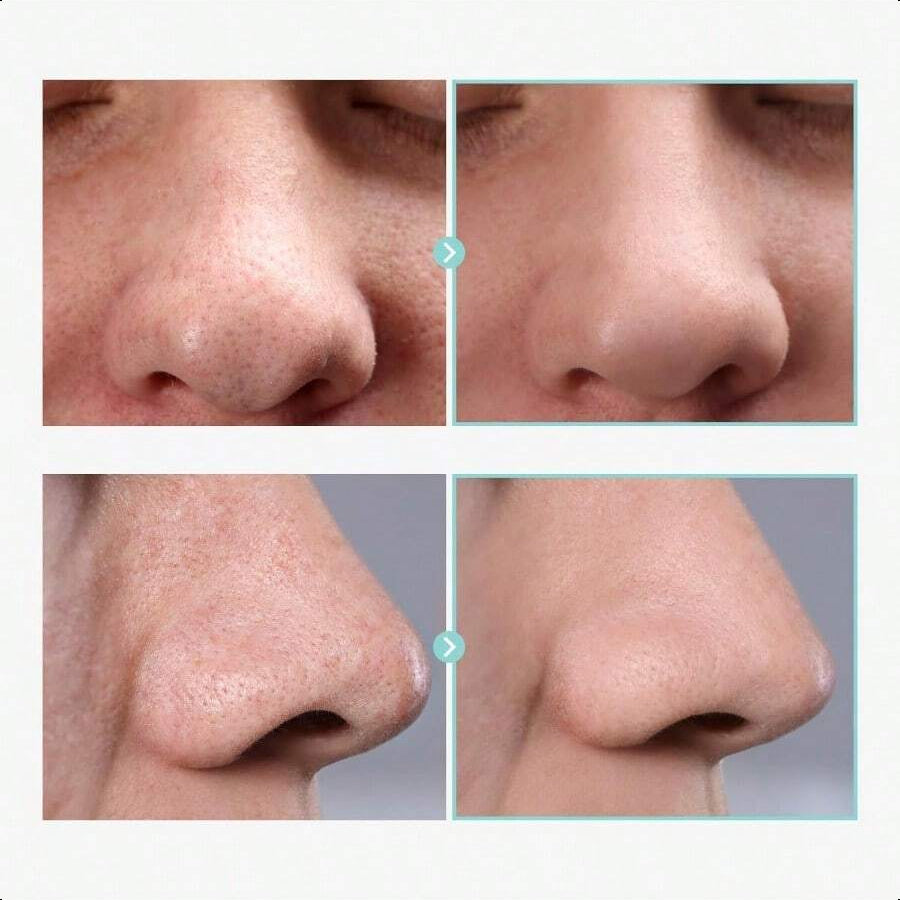 Tosowoong Pore Tightening Serum 30ml/1.01oz | Fast-Acting Formula With Niacinamide & Allantoin, Instantly Reduces Pores