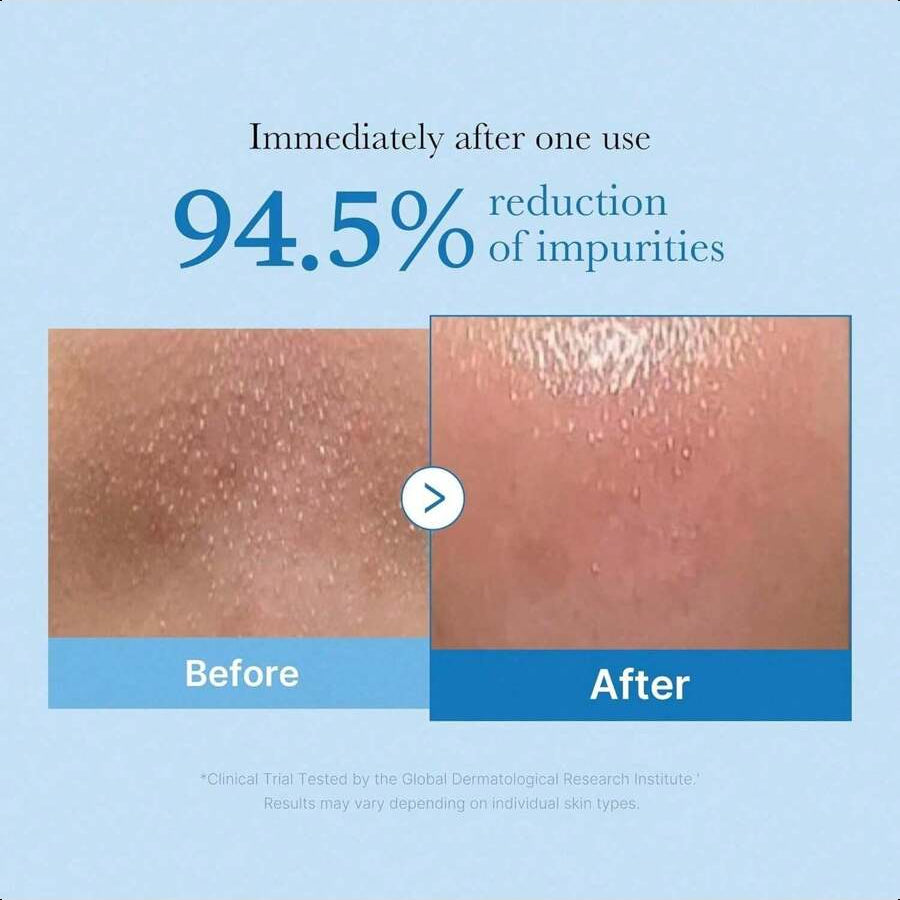 Medicube Zero Pore Blackhead Deep Cleansing Oil  205ml