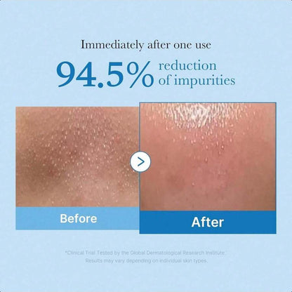 Medicube Zero Pore Blackhead Deep Cleansing Oil  205ml