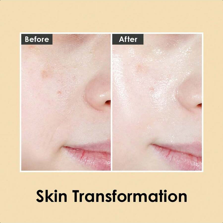 Medipeel Pure Gold 24K Ampoule 3.38 Fl.Oz / 100ml | 99.9% 24K Pure Gold All In One Ampoule, 5 Revitalizing Extracts To Minimize Moisture Loss, Brightens | Korean Skincare, For All Skin Types