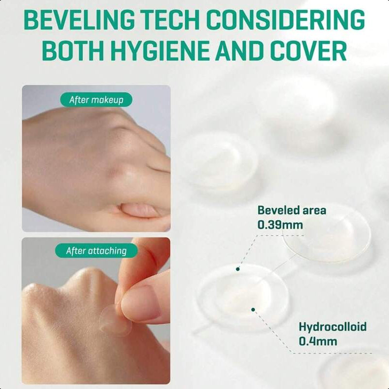 SOME BY MI 30 Days Miracle Clear Spot Patch - Pack Of 5, 90 Counts, 2 Size(10mm 45Counts, 12mm 45Counts)