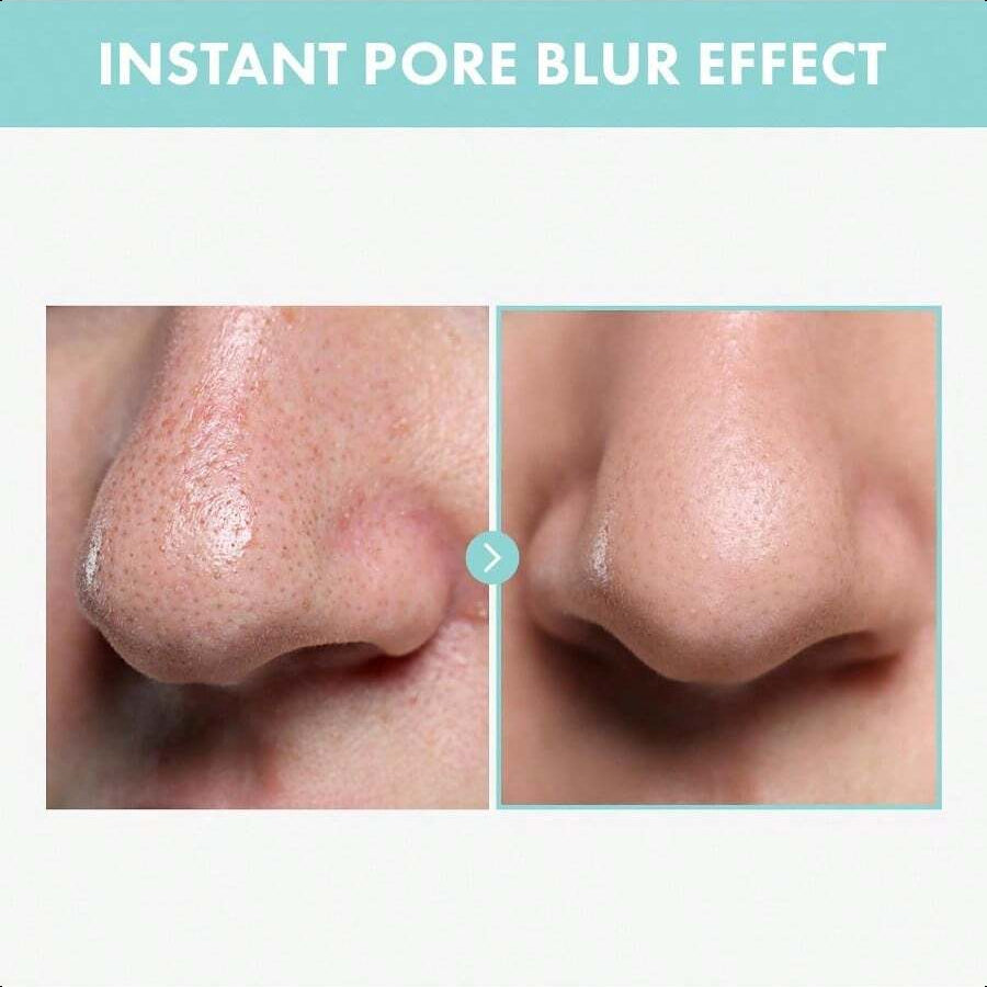 Tosowoong Pore Tightening Serum 30ml/1.01oz | Fast-Acting Formula With Niacinamide & Allantoin, Instantly Reduces Pores