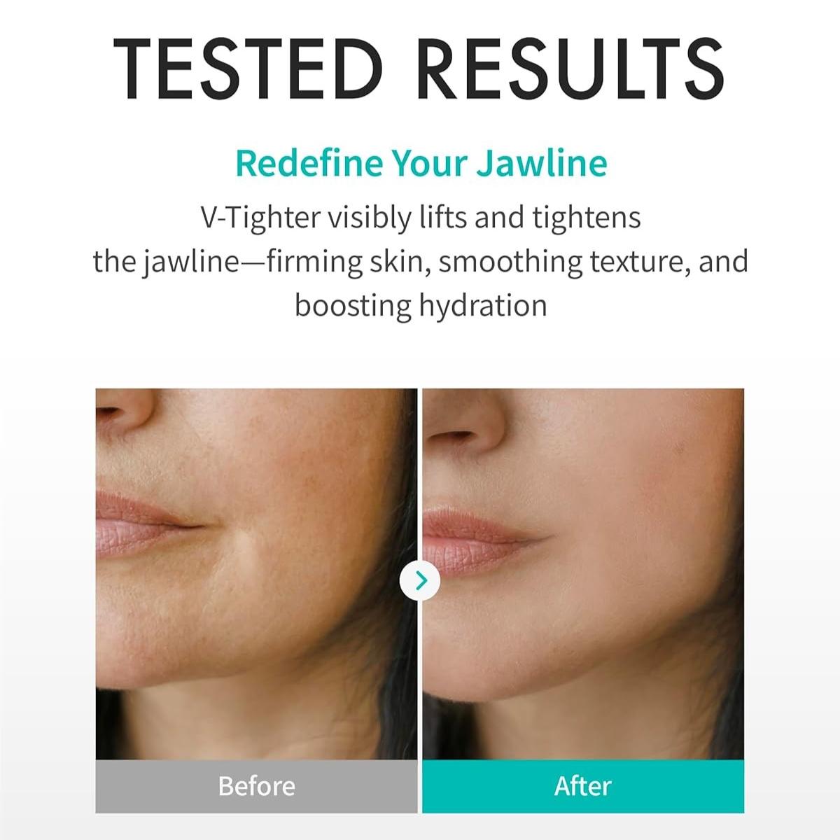 REJURAN Ampoule Infused Lifting Mask 28g*4PCS