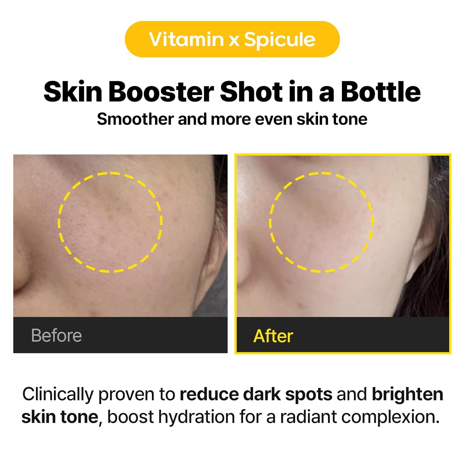 Cell Fusion C Toning C Vita Shot Ampoule 20ml