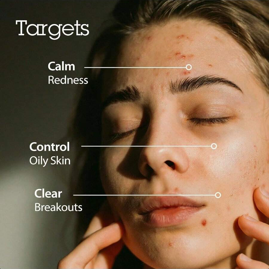 Blithe Korean Skin Care Products 6 Leaves Clear Essence For Rosacea & Redness Relief