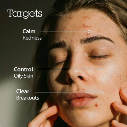 Blithe Korean Skin Care Products 6 Leaves Clear Essence For Rosacea & Redness Relief