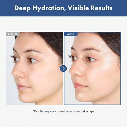 Tosowoong Hyaluronic Acid 3% Serum 30ml/1.01 Oz, 30,030ppm Sodium Hyaluronic Acid, Hydration