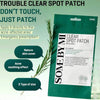 SOME BY MI 30 Days Miracle Clear Spot Patch - Pack Of 5, 90 Counts, 2 Size(10mm 45Counts, 12mm 45Counts)