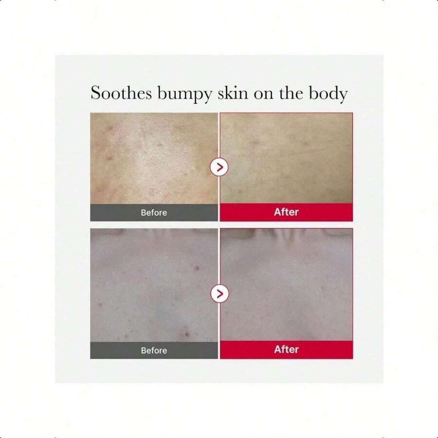 Medicube Red Body Peeling Shot Cleanser 110g