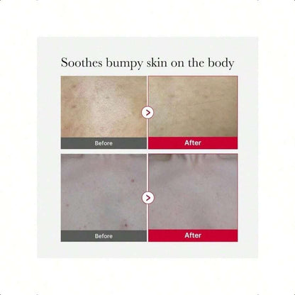Medicube Red Body Peeling Shot Cleanser 110g