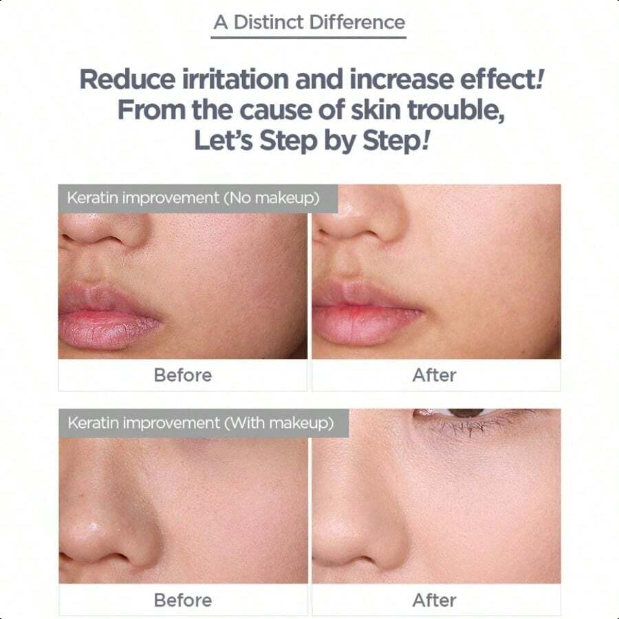 KLAVUU Green Pearlsation Pha Calming Serum 120ml/4.1oz | Mild Exfoliating Serum Infused With Polyhydroxy Acid (Pha) | Contains Tea Tree