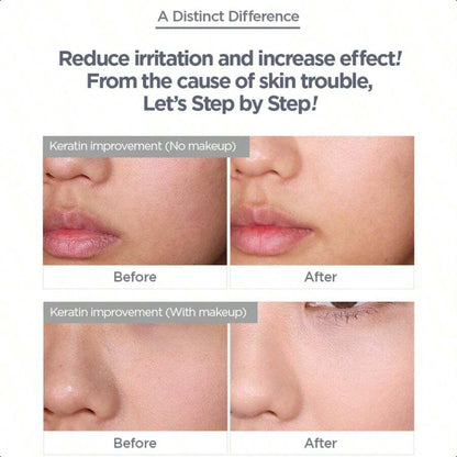 KLAVUU Green Pearlsation Pha Calming Serum 120ml/4.1oz | Mild Exfoliating Serum Infused With Polyhydroxy Acid (Pha) | Contains Tea Tree