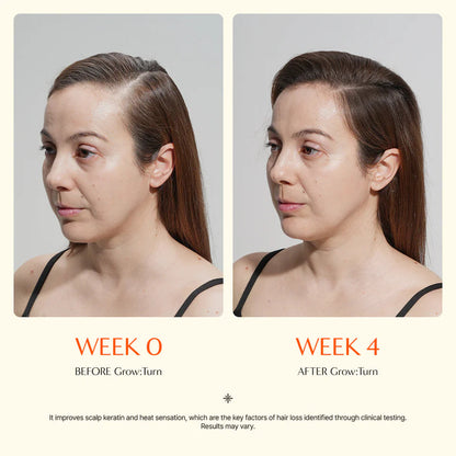 LILYEVE exosome scalp treatment for thinning hair