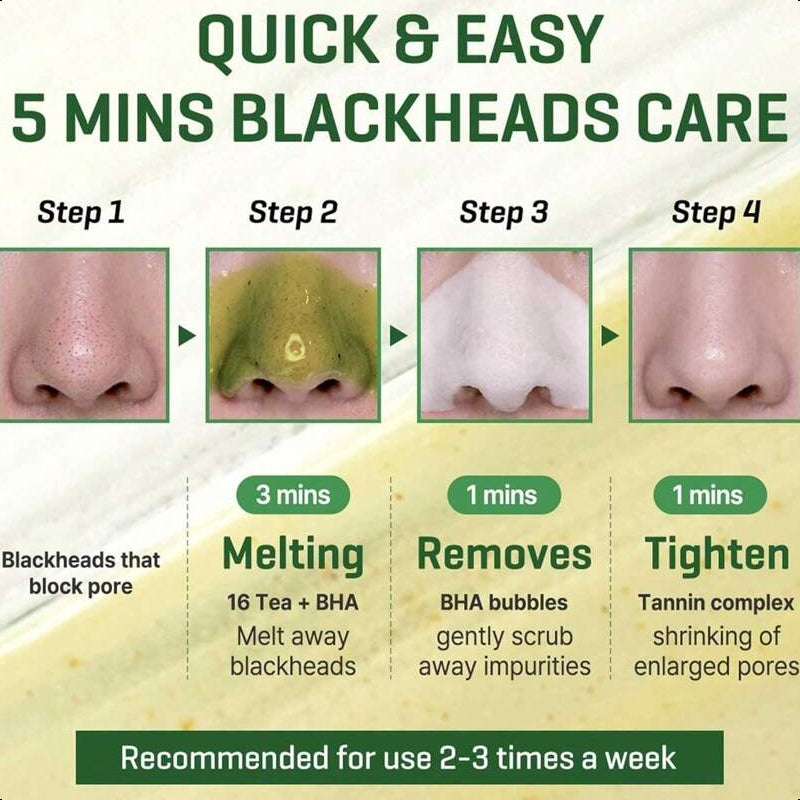 SOME BY MI Bye Bye Blackhead 30 Days Miracle Green Tea Tox Bubble Cleanser 4.23oz, 120g