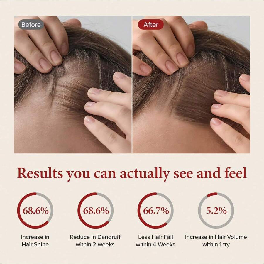 kundal Caffeine Scalp Shampoo, 16.9 Fl Oz (500 Ml), Cherry Blossom