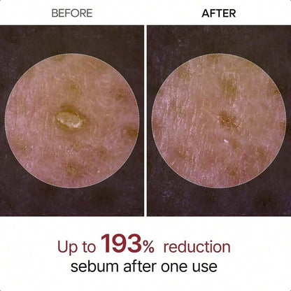 Dr.Melaxin Peel Shot Glow White Rice Peeling Ampoule 80ml