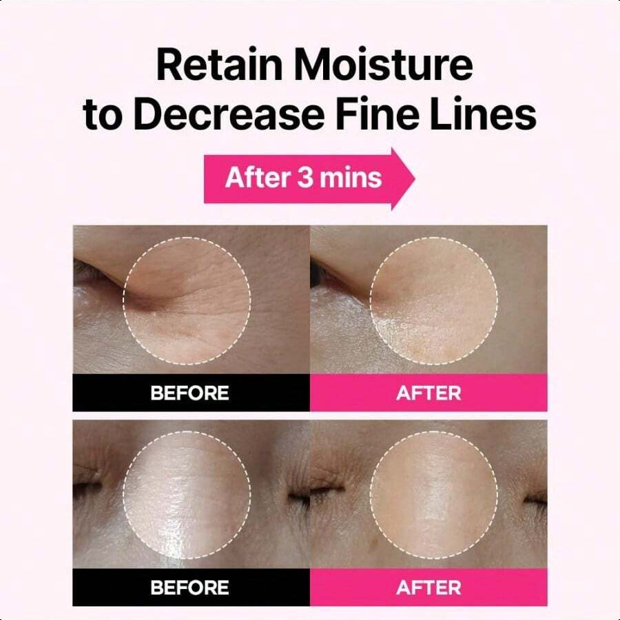 Isoi Blemish Care Eye & Wrinkle Patch 90g/3.17oz