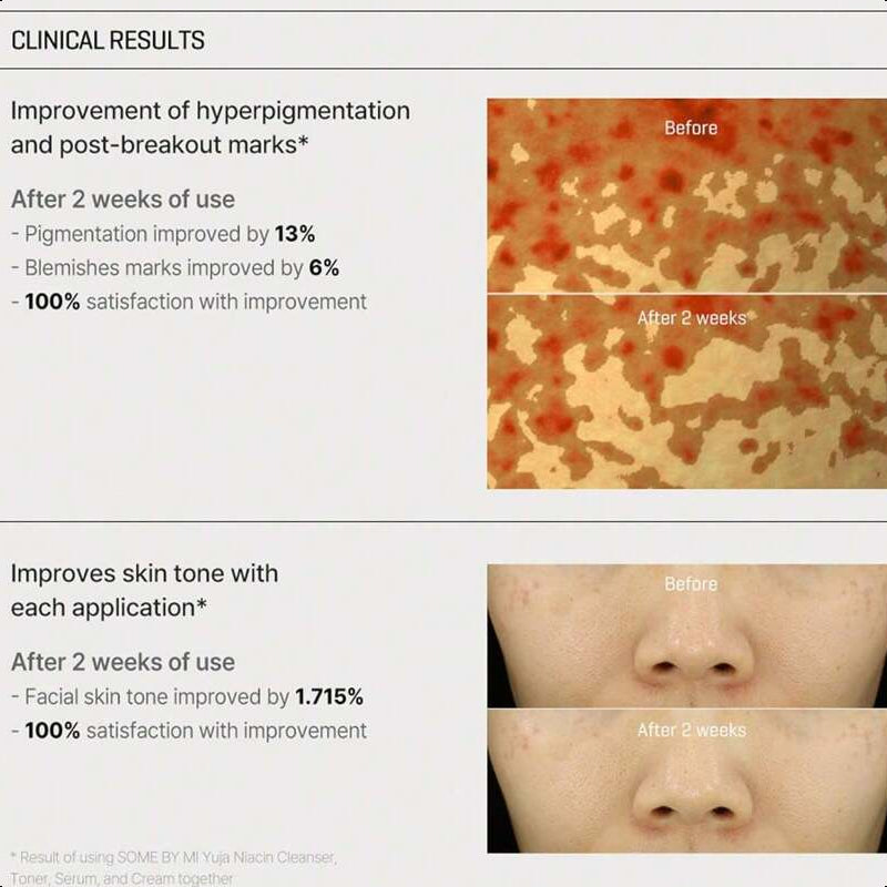 SOME BY MI Yuja Niacin Anti Blemish Cream - 2.02Oz, 60ml