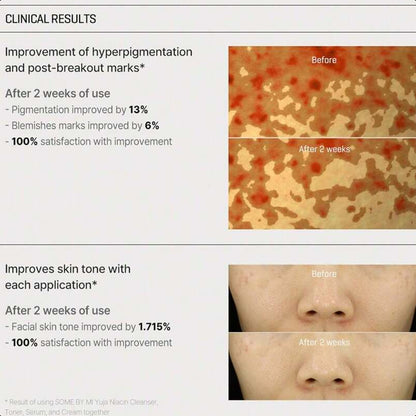 SOME BY MI Yuja Niacin Anti Blemish Cream - 2.02Oz, 60ml