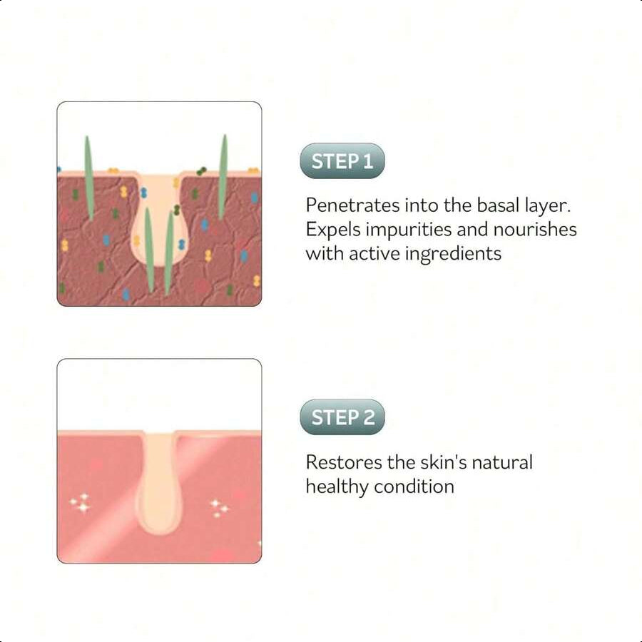 PESTLO Rejurecipe Spicule Roller Serum 50ml (1.69 Fl Oz) - Exfoliating & Hydrating Serum With Spicule Technology For Face, Neck, Décolleté