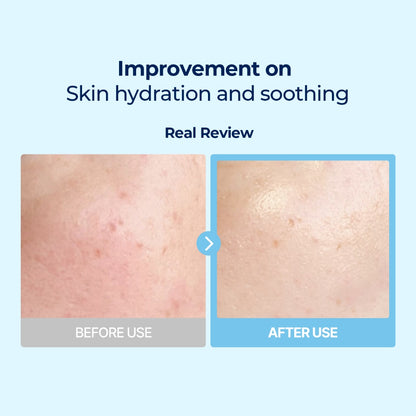 Torriden - DIVE-IN Low Molecule Hyaluronic Acid Multi Pad 80ea
