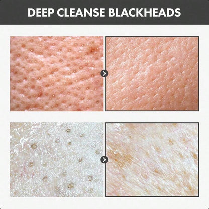 Tosowoong Blackhead Peel Off Pack 50g