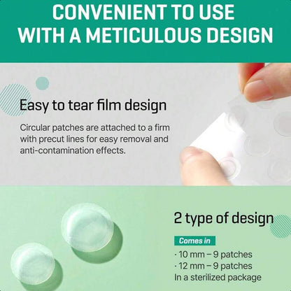 SOME BY MI 30 Days Miracle Clear Spot Patch - Pack Of 5, 90 Counts, 2 Size(10mm 45Counts, 12mm 45Counts)