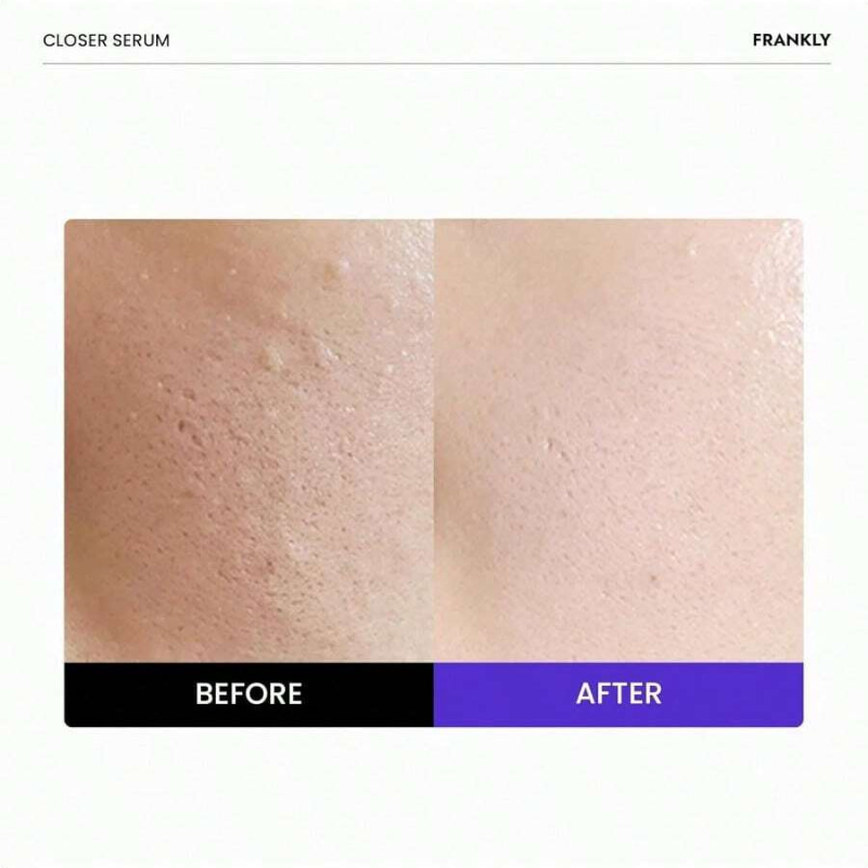 FRANKLY Closer Serum Jumbo 60ml