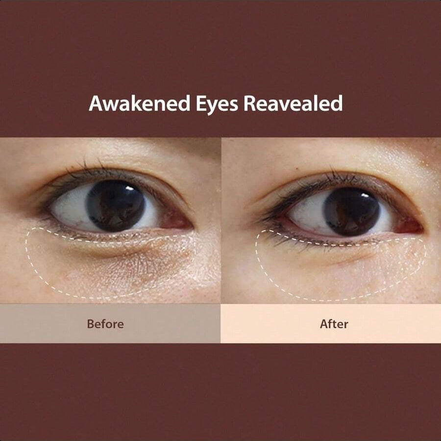 Blithe Caffeine Eye Serum For Dark Circles And Puffiness, Plant-Based Retinol, Bakuchiol, Niacinamide, Sodium Ascorbyl Phosphate 0.67 Fl Oz