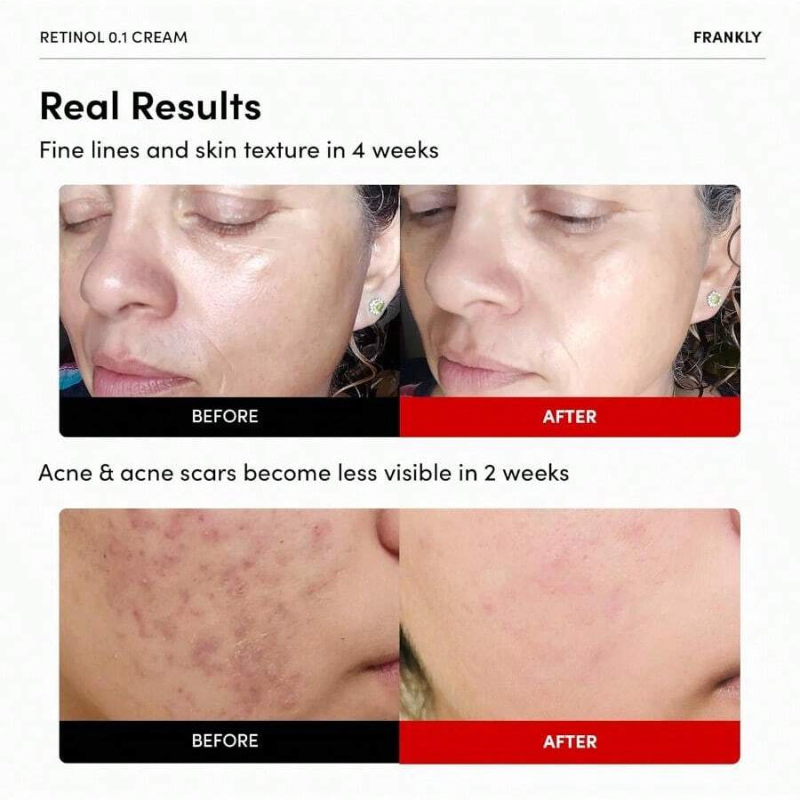 FRANKLY Retinol 0.3% Cream 20ml