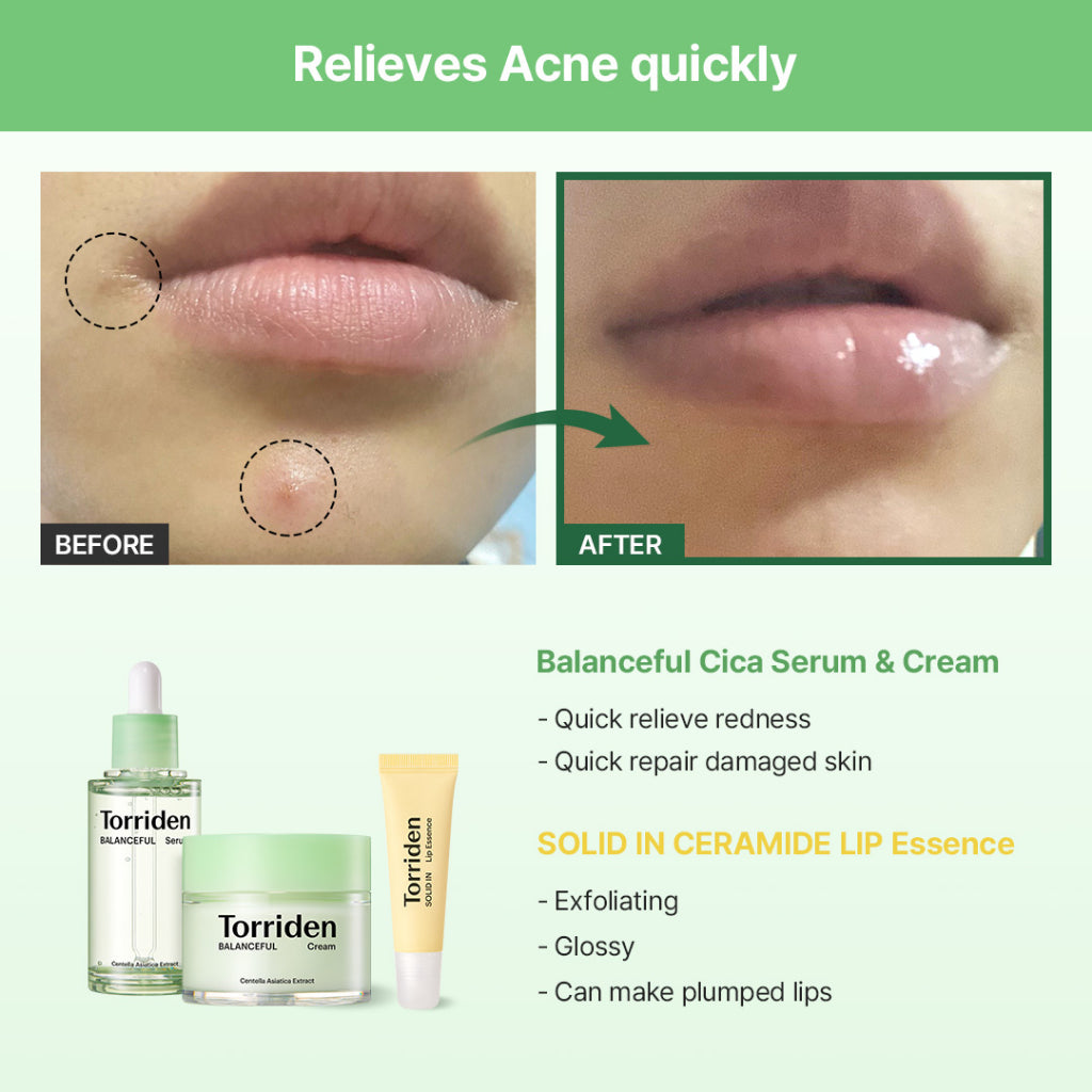 Torriden  SOLID IN Lip Essence 11ml