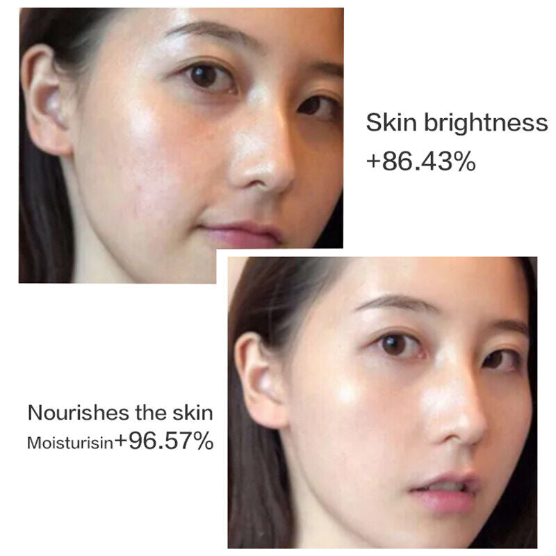 Sudee Brighten and Moisturizing Facial Masksheet Whitening Hydrating and Brightening