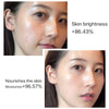 Sudee Brighten and Moisturizing Facial Masksheet Whitening Hydrating and Brightening